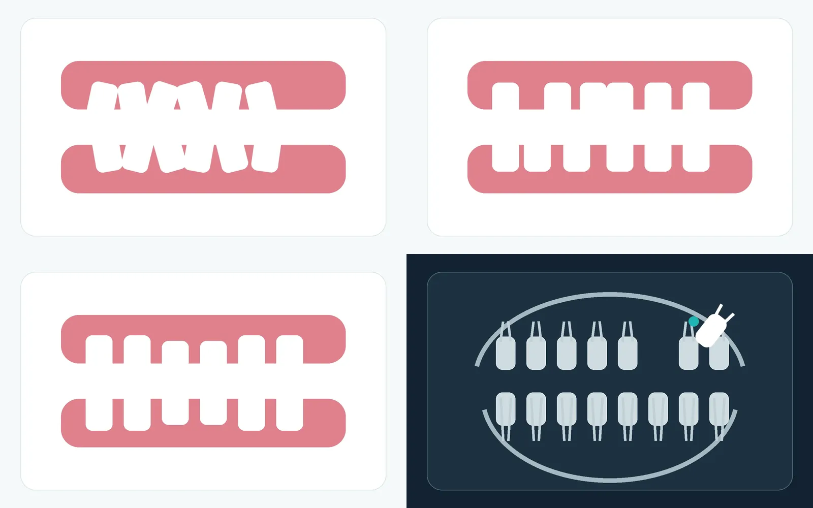 Illustrations of common orthodontic conditions