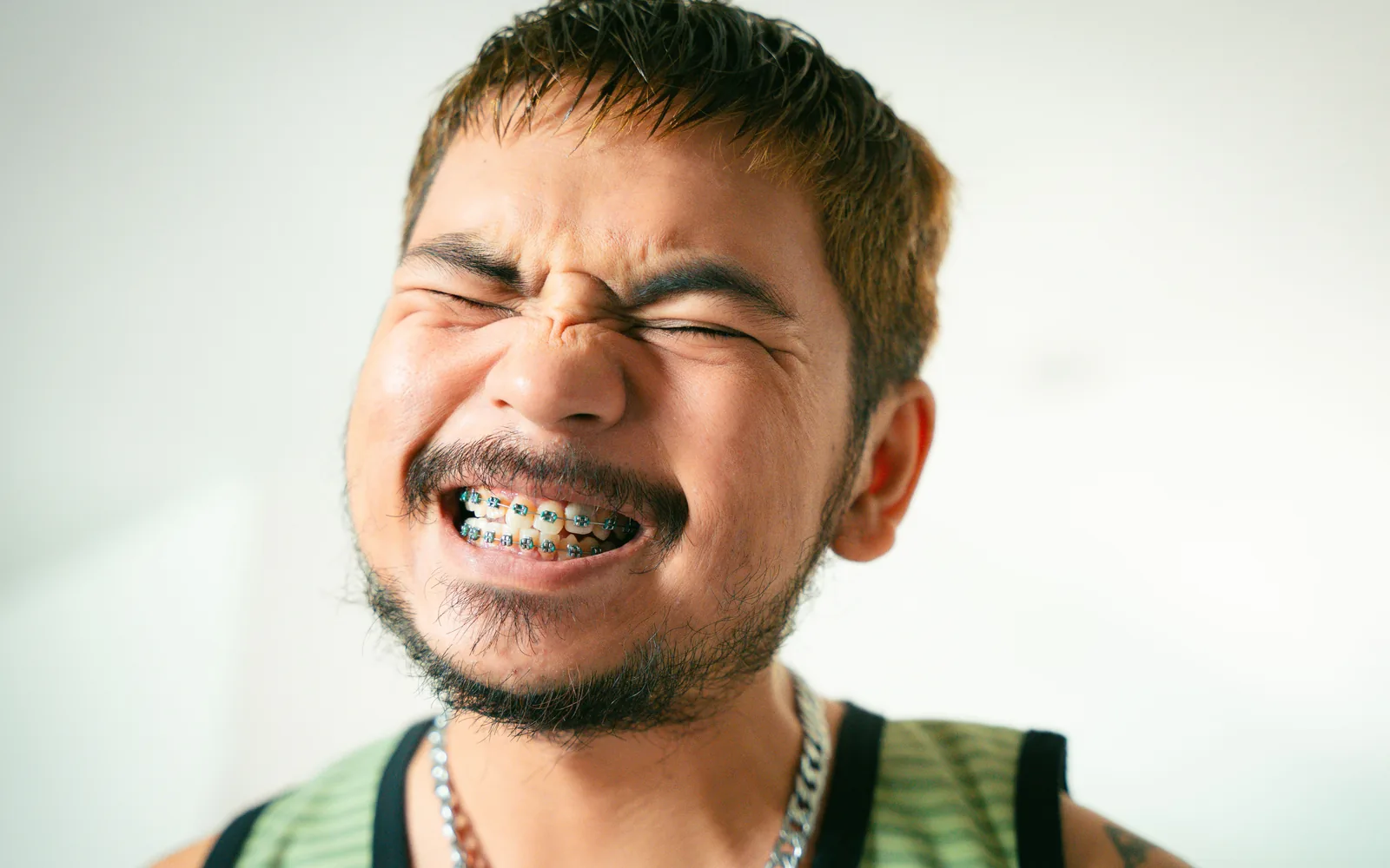 Adult man smiling with orthodontic braces