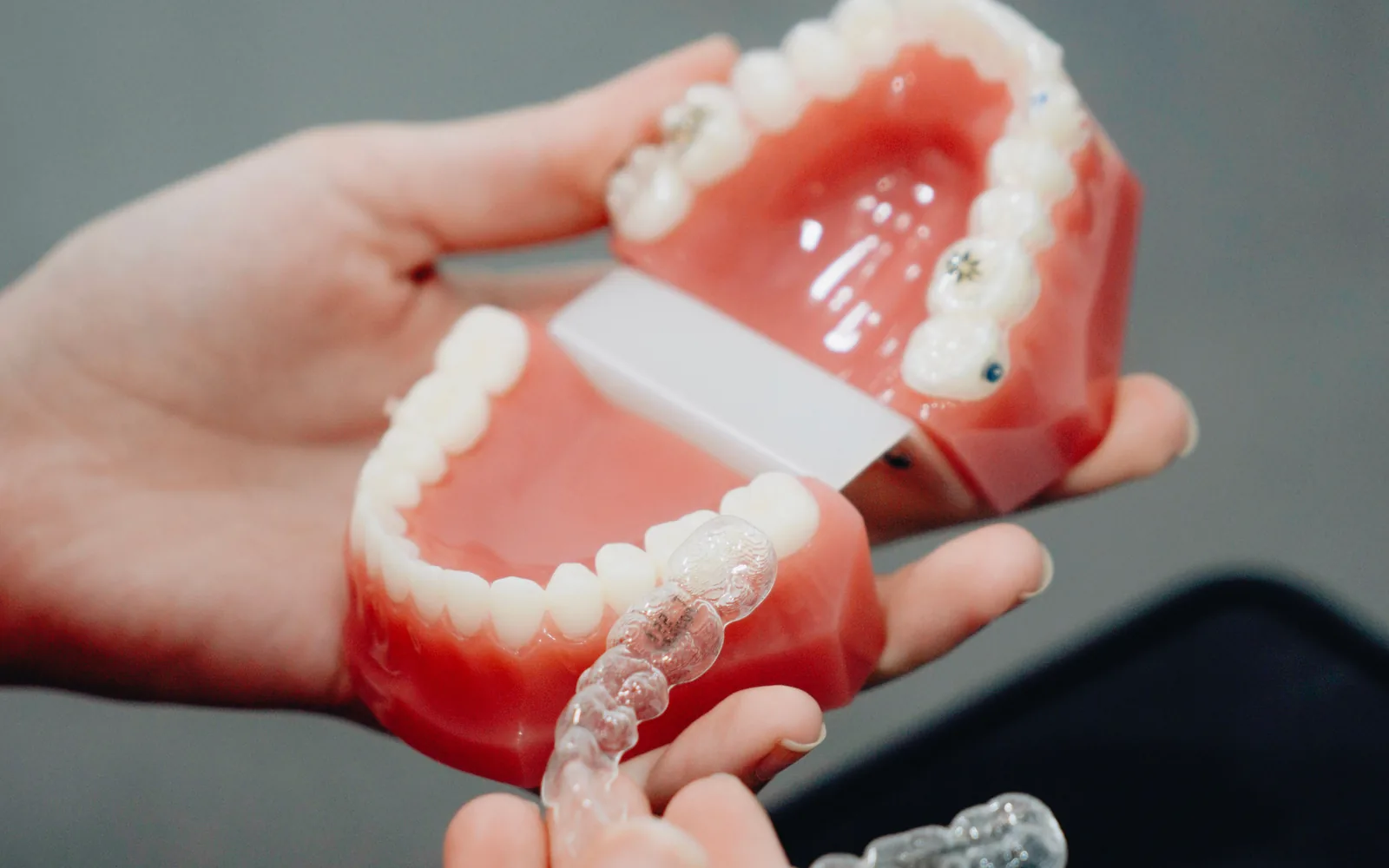 Clear orthodontic aligner shown with a dental model